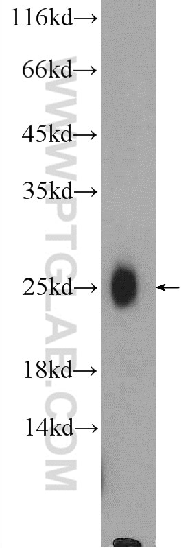 Western Blot (WB) analysis of A375 cells using BAALC Polyclonal antibody (24997-1-AP)