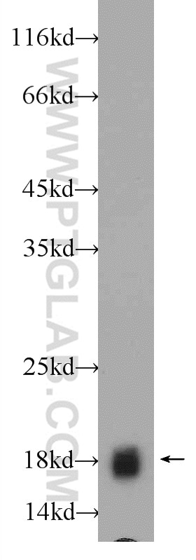 Western Blot (WB) analysis of HEK-293 cells using BAALC Polyclonal antibody (24997-1-AP)