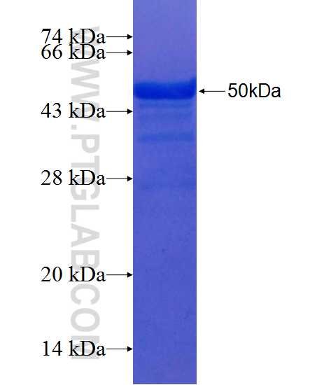BAALC fusion protein Ag21850 SDS-PAGE