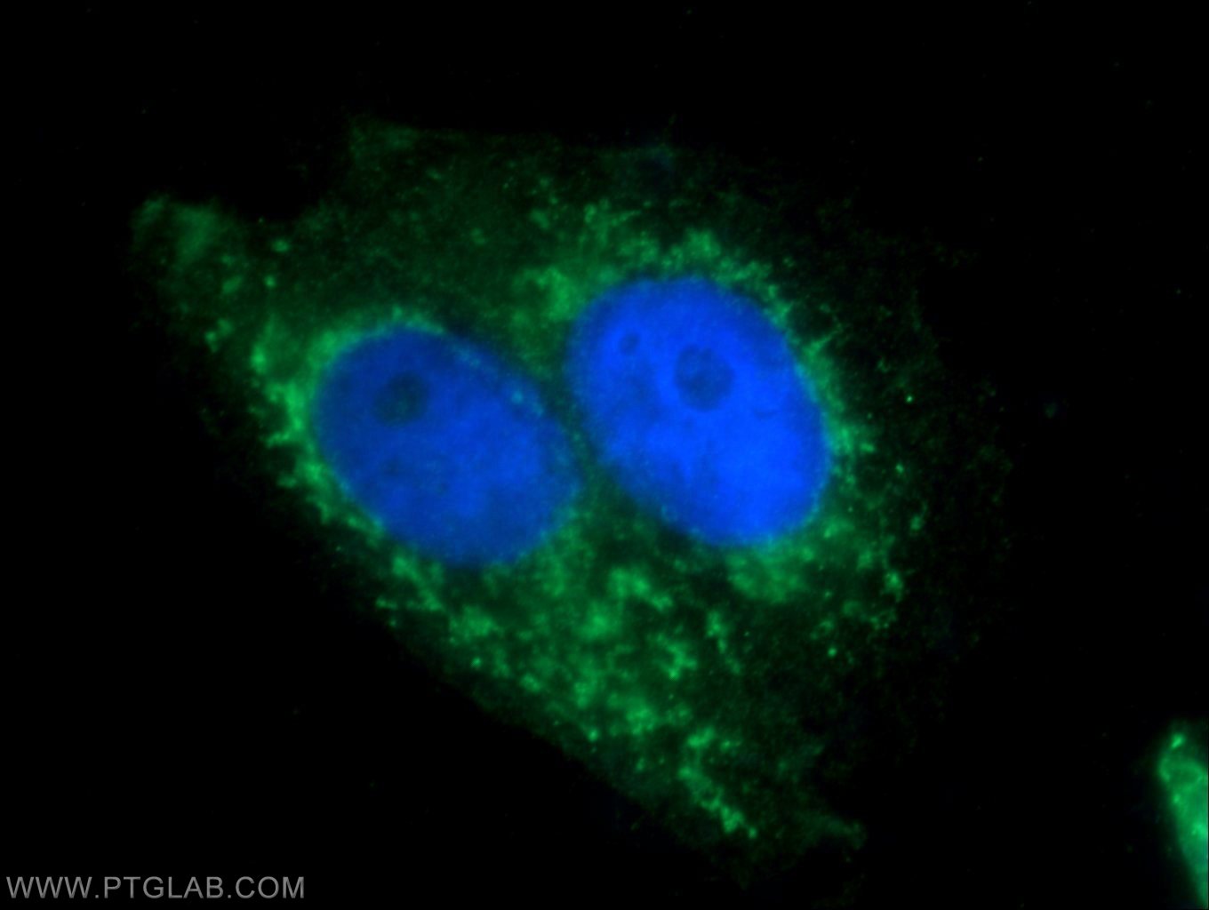 Immunofluorescence (IF) / fluorescent staining of HepG2 cells using BAAT Polyclonal antibody (15990-1-AP)