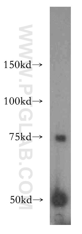 Western Blot (WB) analysis of human liver tissue using BAAT Polyclonal antibody (15990-1-AP)