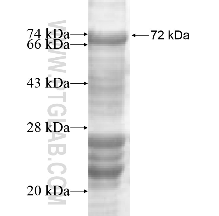 BAAT fusion protein Ag8860 SDS-PAGE