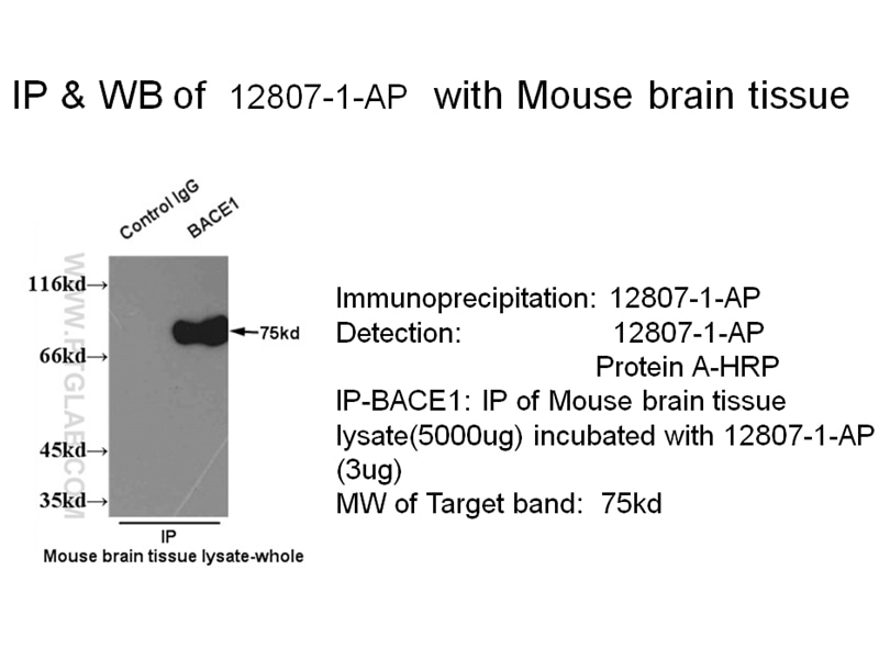 Immunoprecipitation (IP) experiment using BACE1 Polyclonal antibody (12807-1-AP)