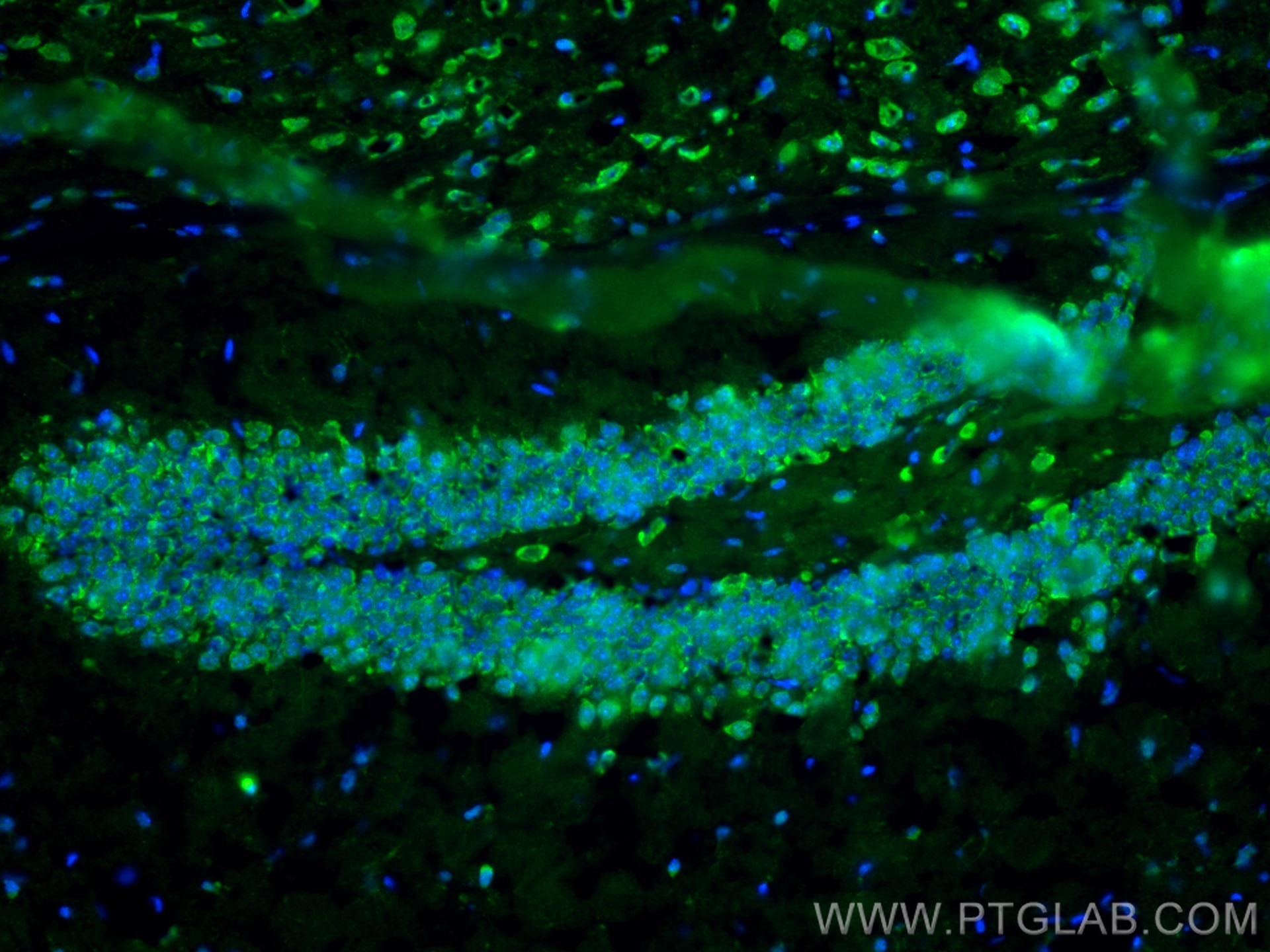 Immunofluorescence (IF) / fluorescent staining of mouse brain tissue using BACE1 Polyclonal antibody (12807-1-AP)