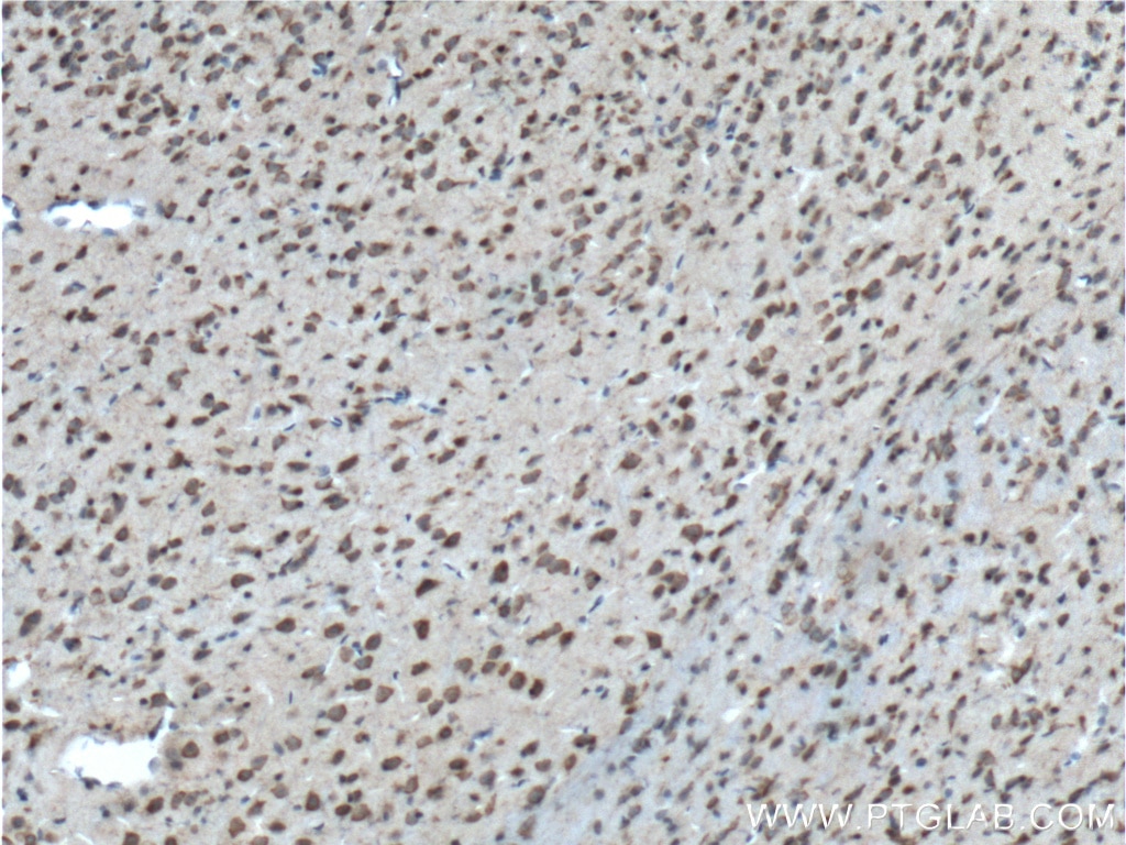 Immunohistochemistry (IHC) staining of mouse brain tissue using BACE1 Polyclonal antibody (12807-1-AP)