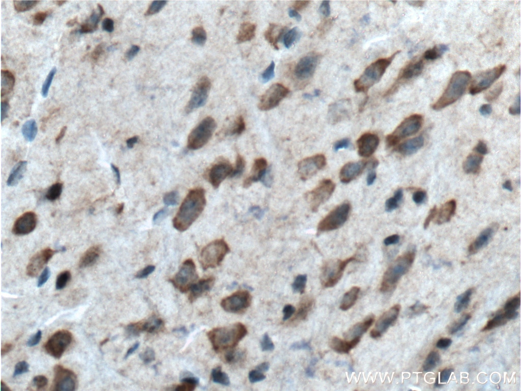 Immunohistochemistry (IHC) staining of mouse brain tissue using BACE1 Polyclonal antibody (12807-1-AP)