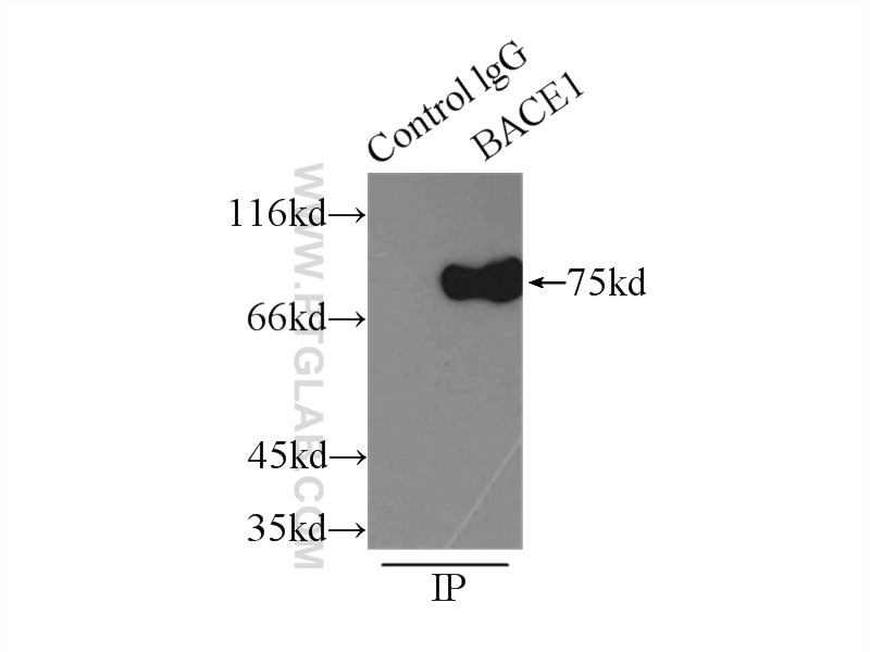 Immunoprecipitation (IP) experiment of mouse brain tissue using BACE1 Polyclonal antibody (12807-1-AP)