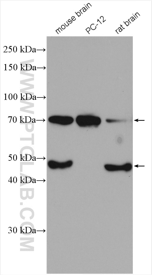 Western Blot (WB) analysis of various lysates using BACE1 Polyclonal antibody (12807-1-AP)