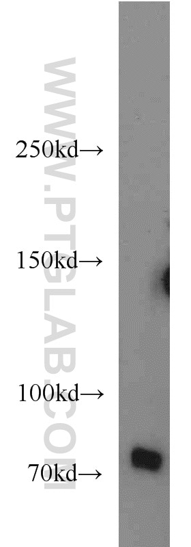 Western Blot (WB) analysis of mouse brain tissue using BACE1 Polyclonal antibody (12807-1-AP)