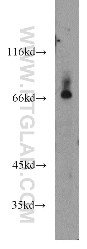 Western Blot (WB) analysis of mouse brain tissue using BACE1 Polyclonal antibody (12807-1-AP)