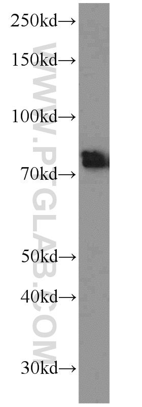 Western Blot (WB) analysis of mouse brain tissue using BACE1 Polyclonal antibody (12807-1-AP)