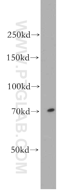 Western Blot (WB) analysis of human brain tissue using BACE1 Polyclonal antibody (12807-1-AP)