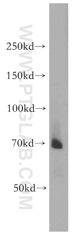 Western Blot (WB) analysis of mouse pancreas tissue using BACE1 Polyclonal antibody (12807-1-AP)