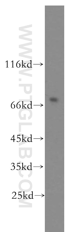 Western Blot (WB) analysis of HeLa cells using BACE1 Polyclonal antibody (12807-1-AP)