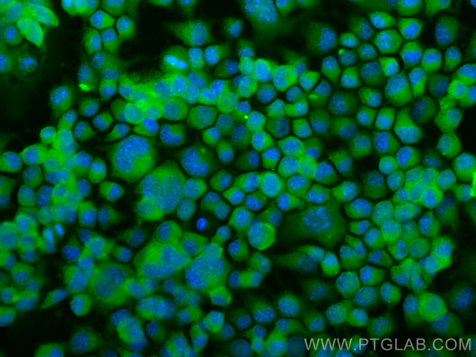 Immunofluorescence (IF) / fluorescent staining of Neuro-2a cells using CoraLite® Plus 488-conjugated BACE1 Polyclonal ant (CL488-12807)