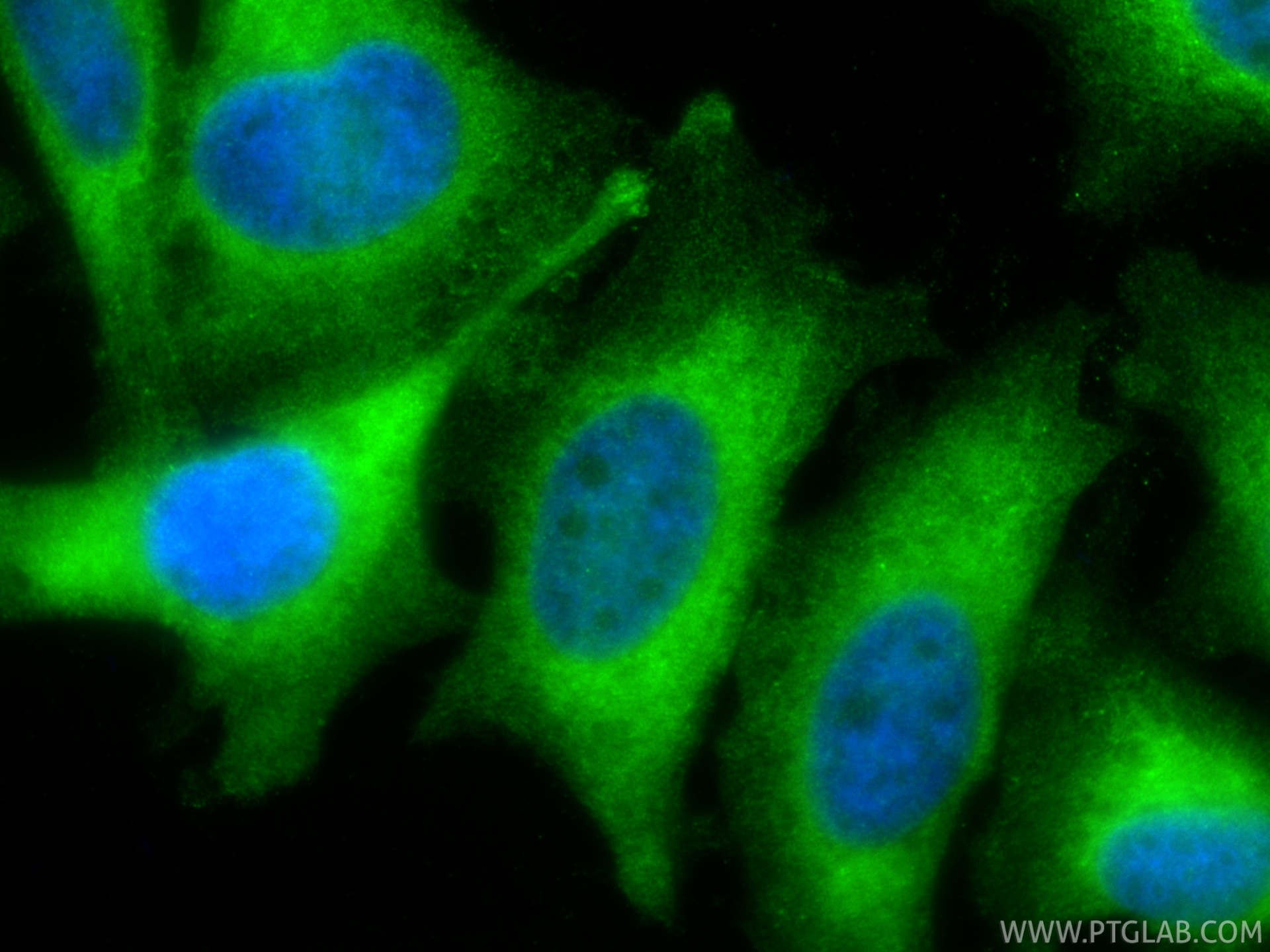 Immunofluorescence (IF) / fluorescent staining of HeLa cells using BAD Polyclonal antibody (10435-1-AP)