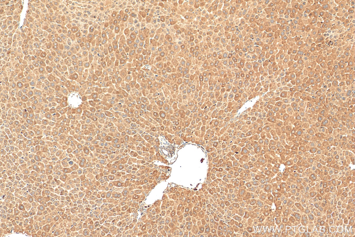 Immunohistochemistry (IHC) staining of mouse liver tissue using BAD Polyclonal antibody (10435-1-AP)