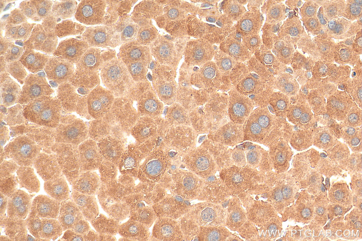 Immunohistochemistry (IHC) staining of mouse liver tissue using BAD Polyclonal antibody (10435-1-AP)