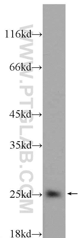 BAD Polyclonal antibody