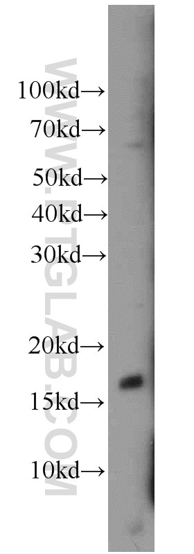 BAD Polyclonal antibody