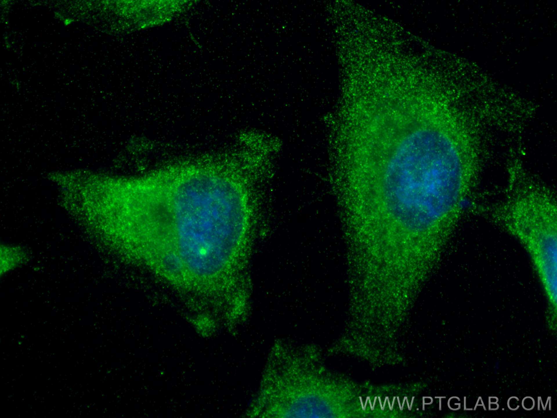 Immunofluorescence (IF) / fluorescent staining of HeLa cells using BAD Monoclonal antibody (67830-1-Ig)