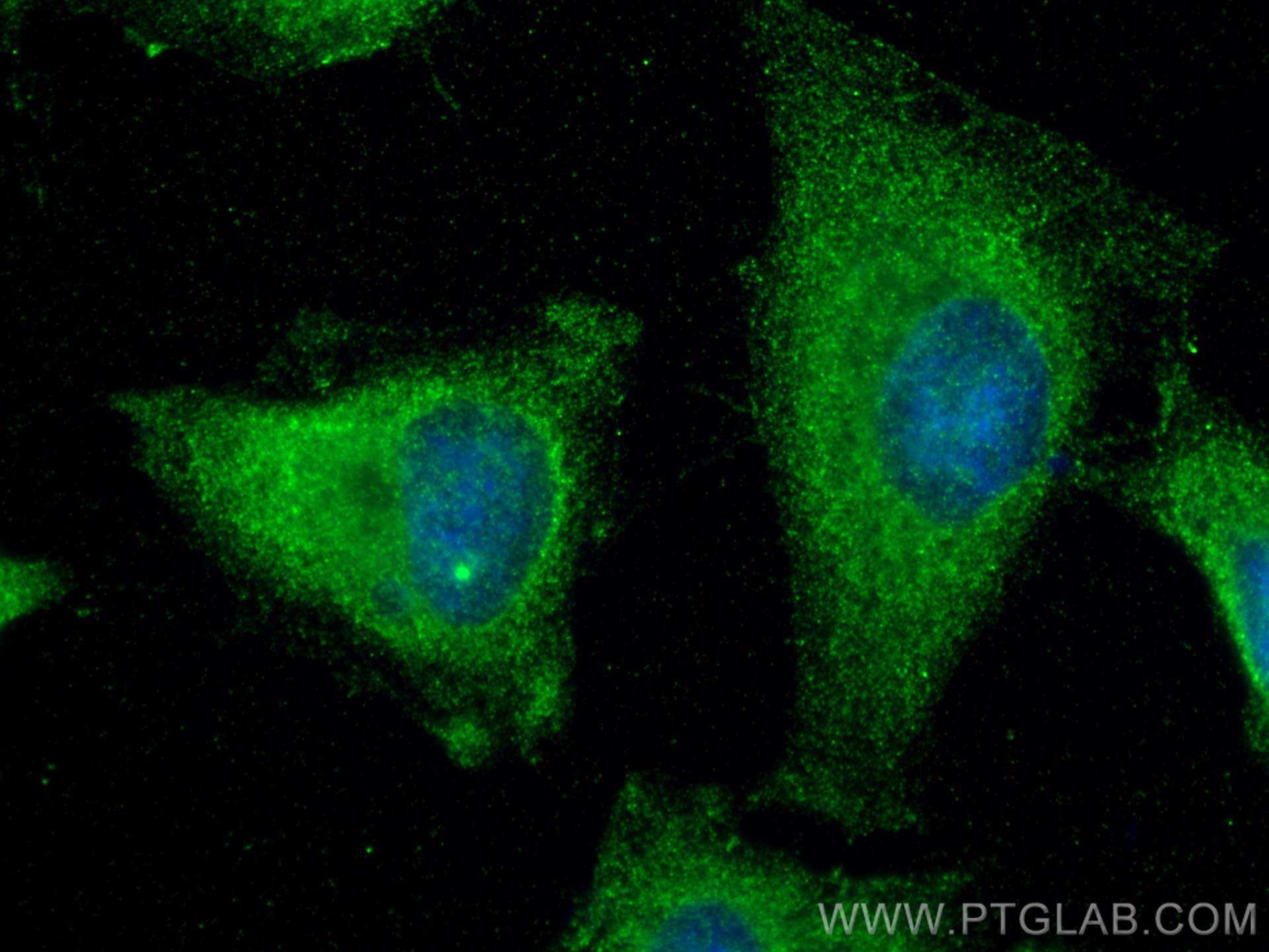 IF Staining of HeLa using 67830-1-Ig