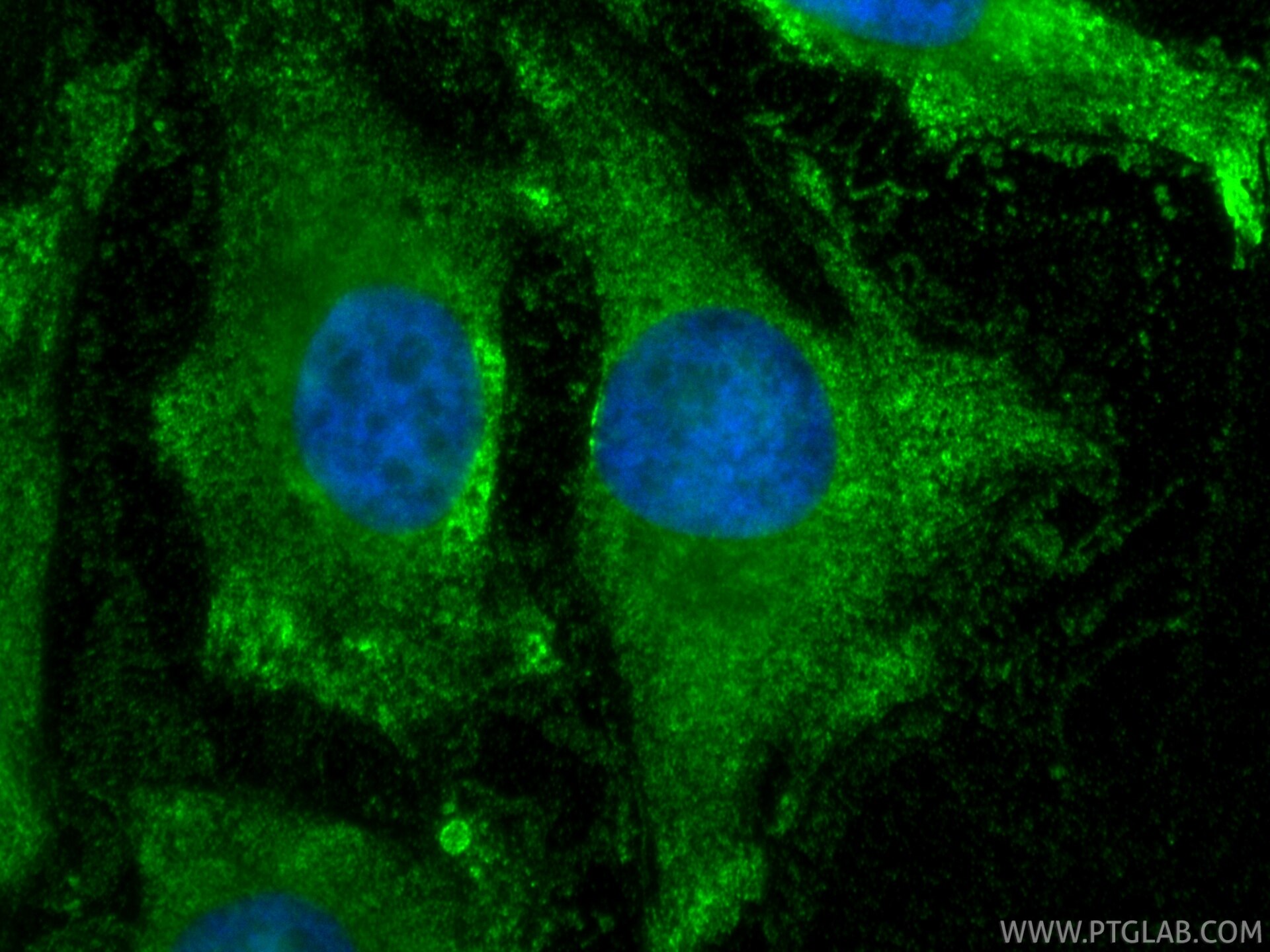 Immunofluorescence (IF) / fluorescent staining of HeLa cells using BAD Monoclonal antibody (67830-1-Ig)