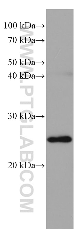 WB analysis of RAW 264.7 using 67830-1-Ig