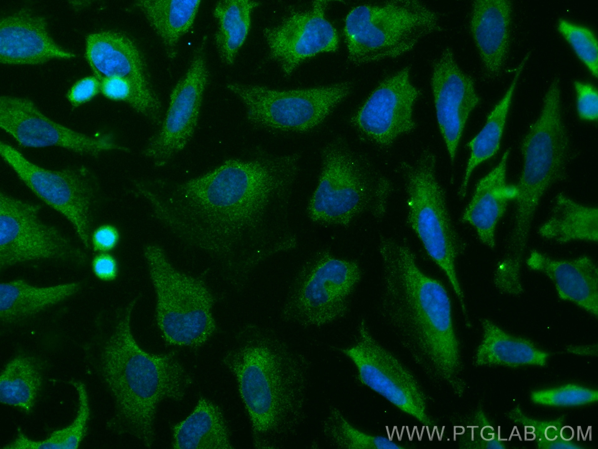Immunofluorescence (IF) / fluorescent staining of HeLa cells using CoraLite® Plus 488-conjugated BAD Monoclonal antib (CL488-67830)