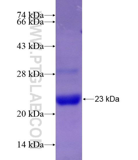 BAD fusion protein Ag21382 SDS-PAGE