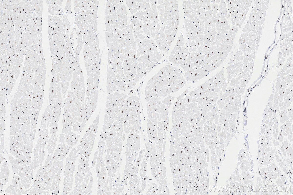 Immunohistochemistry (IHC) staining of human heart tissue using BAF170 Recombinant monoclonal antibody (86473-3-RR)