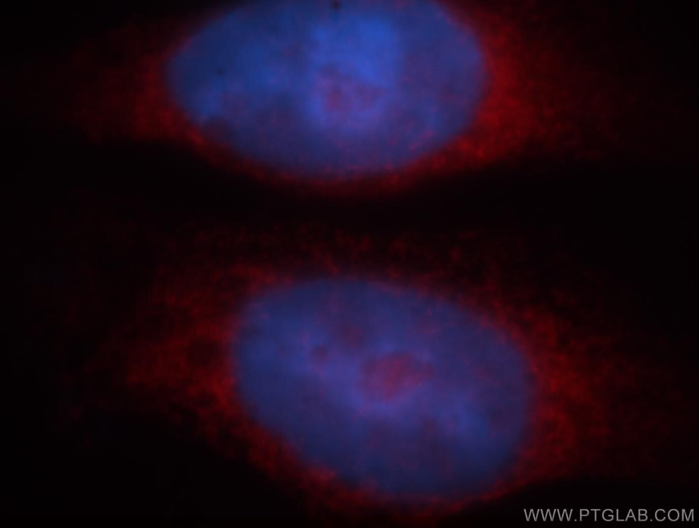 Immunofluorescence (IF) / fluorescent staining of HeLa cells using BAG1 Polyclonal antibody (19064-1-AP)