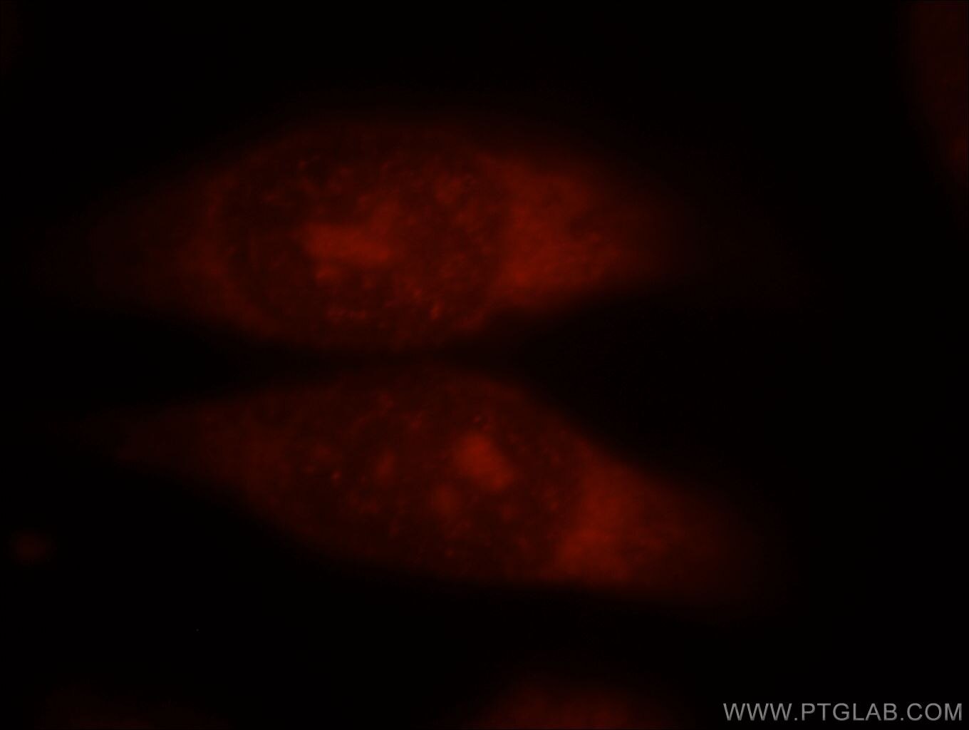 IF Staining of MCF-7 using 19064-1-AP