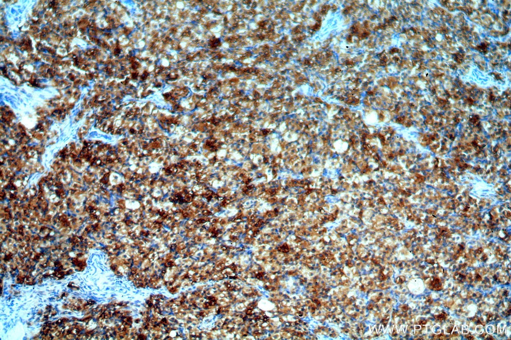 Immunohistochemistry (IHC) staining of human ovary tissue using BAG1 Polyclonal antibody (19064-1-AP)