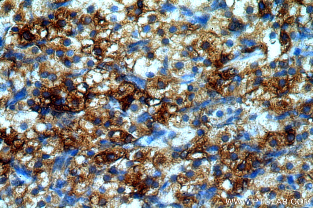 Immunohistochemistry (IHC) staining of human ovary tissue using BAG1 Polyclonal antibody (19064-1-AP)