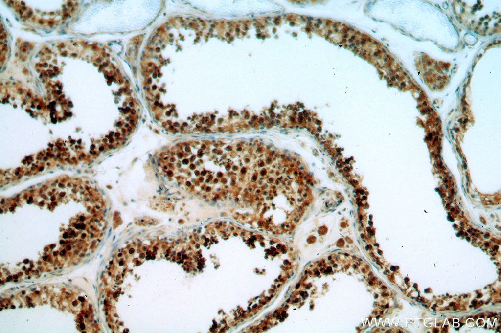 Immunohistochemistry (IHC) staining of human testis tissue using BAG1 Polyclonal antibody (19064-1-AP)