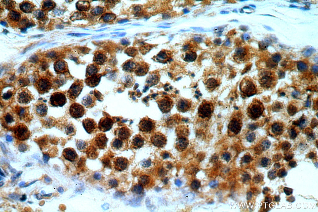 Immunohistochemistry (IHC) staining of human testis tissue using BAG1 Polyclonal antibody (19064-1-AP)