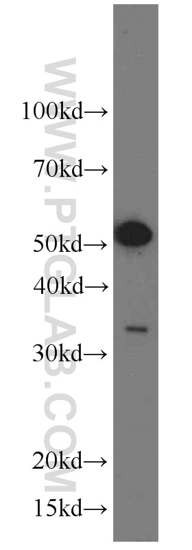 Western Blot (WB) analysis of HeLa cells using BAG1 Polyclonal antibody (19064-1-AP)