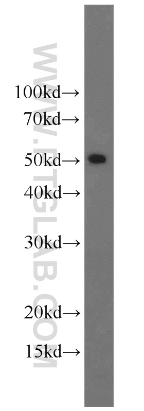 Western Blot (WB) analysis of UV treated Hela using BAG1 Polyclonal antibody (19064-1-AP)
