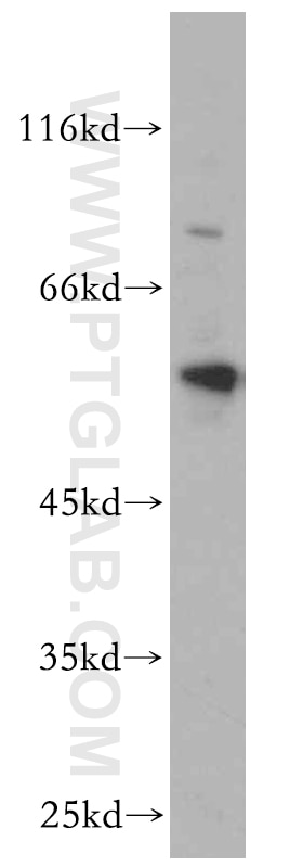 Western Blot (WB) analysis of MCF-7 cells using BAG1 Polyclonal antibody (19064-1-AP)