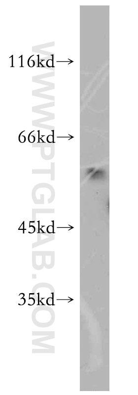 Western Blot (WB) analysis of HEK-293 cells using BAG1 Polyclonal antibody (19064-1-AP)