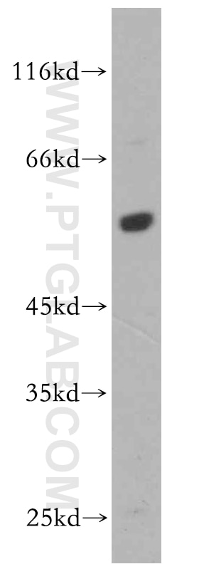 WB analysis of RAW264.7 using 19064-1-AP