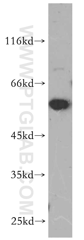 Western Blot (WB) analysis of HL-60 cells using BAG1 Polyclonal antibody (19064-1-AP)