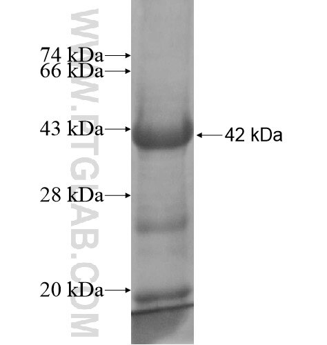BAG1 fusion protein Ag13599 SDS-PAGE