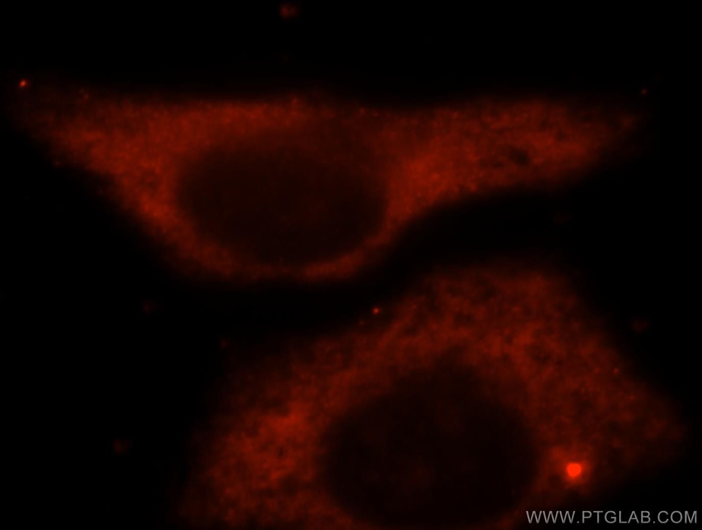 Immunofluorescence (IF) / fluorescent staining of HepG2 cells using BAG1L-specific Polyclonal antibody (16148-1-AP)