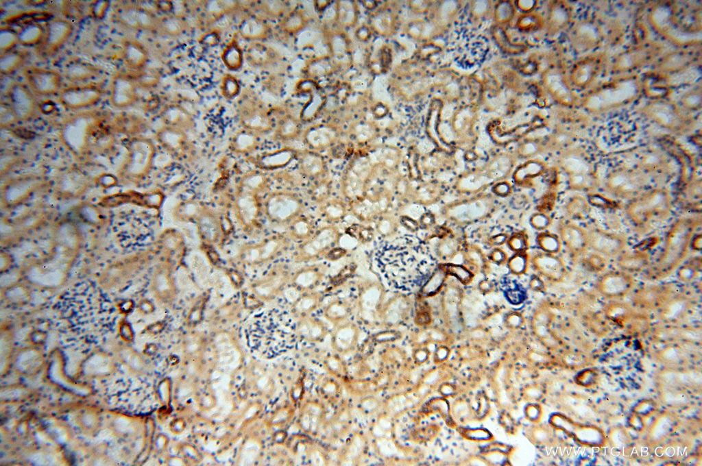 Immunohistochemistry (IHC) staining of human kidney tissue using BAG1S/1M/1L Polyclonal antibody (16150-1-AP)