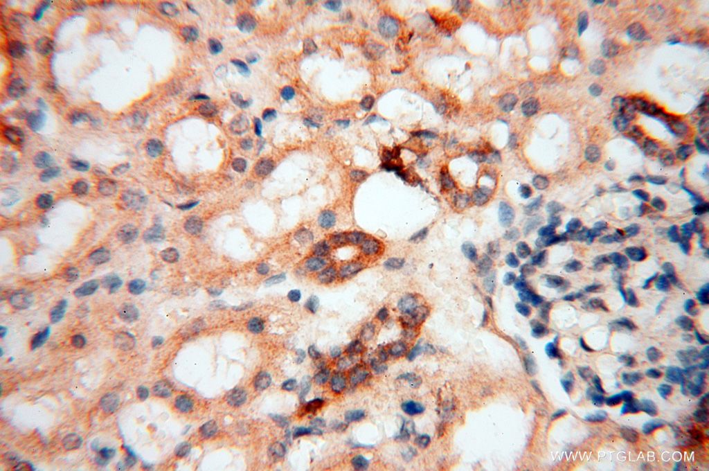 Immunohistochemistry (IHC) staining of human kidney tissue using BAG1S/1M/1L Polyclonal antibody (16150-1-AP)