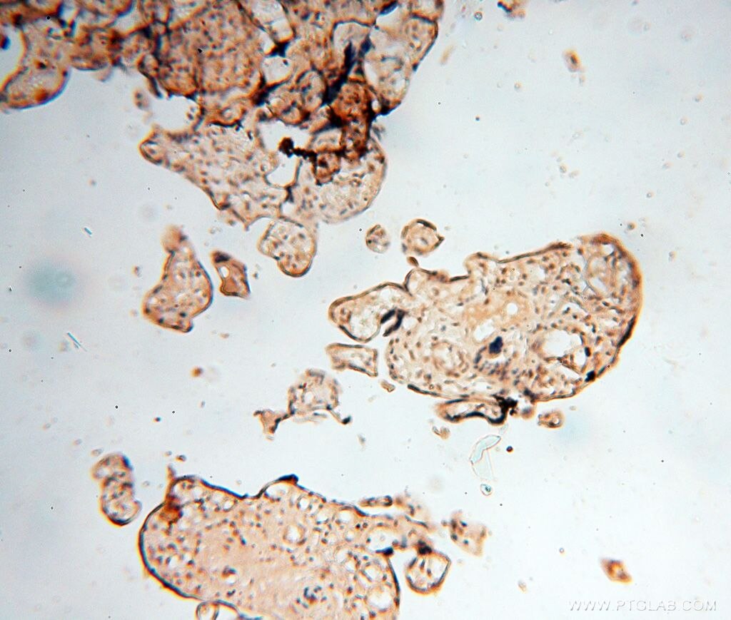 Immunohistochemistry (IHC) staining of human placenta tissue using BAG1S/1M/1L Polyclonal antibody (16150-1-AP)