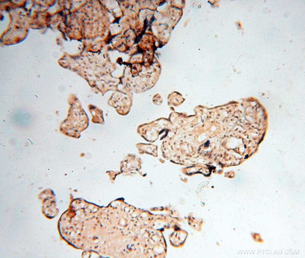 IHC staining of human placenta using 16150-1-AP