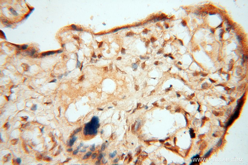 Immunohistochemistry (IHC) staining of human placenta tissue using BAG1S/1M/1L Polyclonal antibody (16150-1-AP)